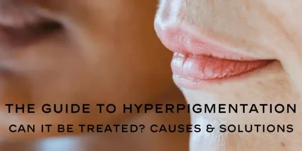 Close-up of two lips illustrating hyperpigmentation with text overlay: "The Guide to Hyperpigmentation - Can It Be Treated? Causes & Solutions."