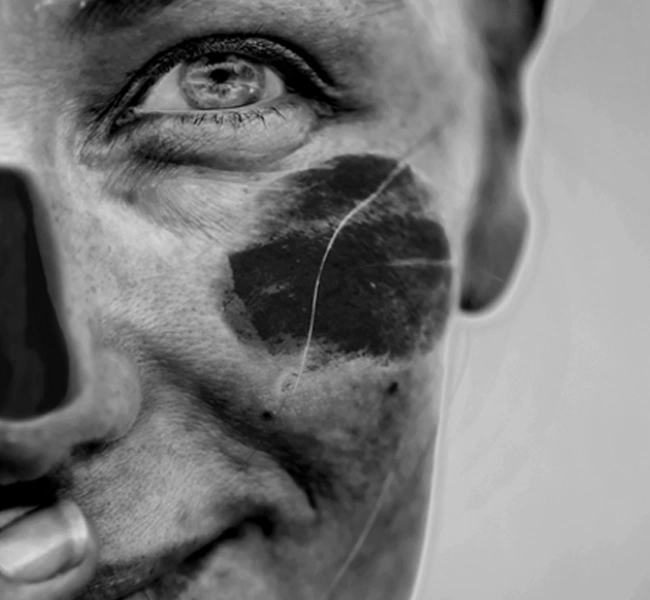Person with facial markings and dirt, emphasizing skin exposure and potential UV damage, relevant to UV protection and skincare analysis.