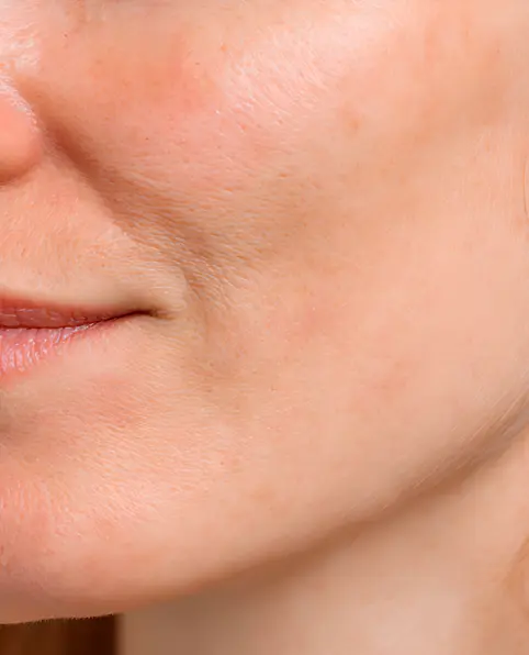 Close-up of revitalized skin showing visible improvement in tone and texture after using the serum.