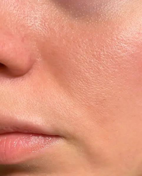 Close-up of a person's cheek and lips, highlighting smooth, slightly textured younger looking skin with a natural, healthy glow. The tone is neutral and serene.