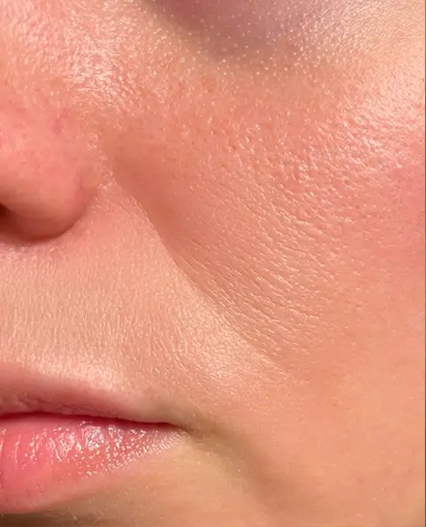 Close-up of the lower half of a woman's face, showing smooth lips and skin texture with fine lines, wrinkles, uneven surface and pores before using the cream. The lighting is soft, creating a natural tone.
