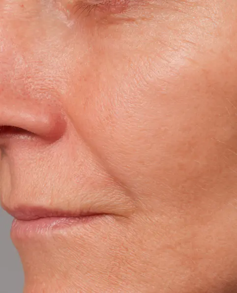 after Fight aging with Green Caviar Facial Oil Elixir. Get smoother, younger-looking skin today!