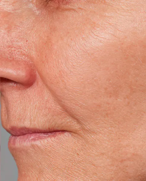 before Fight aging with Green Caviar Facial Oil Elixir. Get smoother, younger-looking skin today!