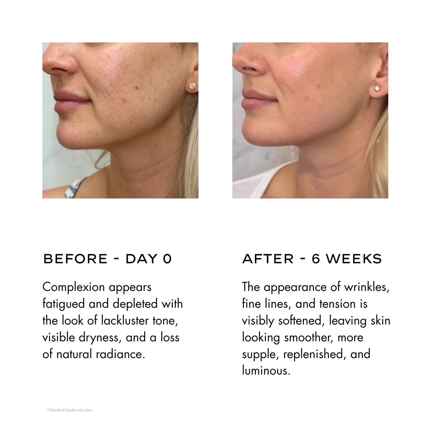 GCFO-6.webp before and after Fight aging with Green Caviar Facial Oil Elixir. Get smoother, younger-looking skin today!