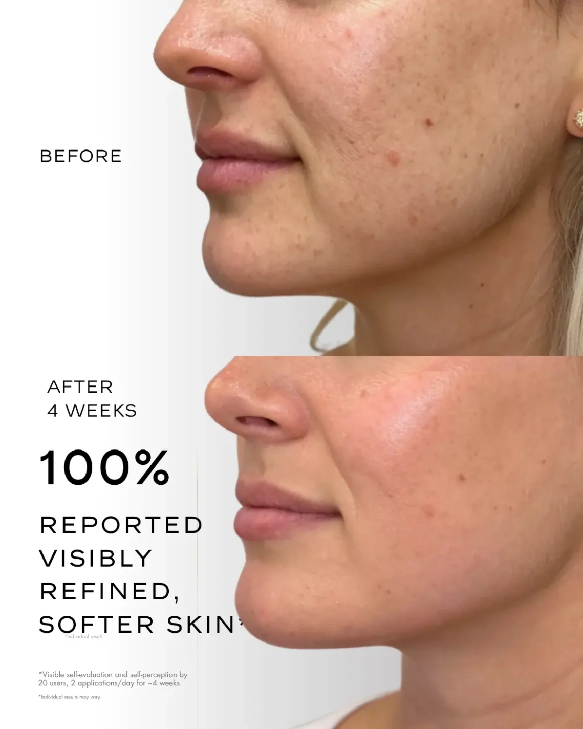 before and after results on woman skin