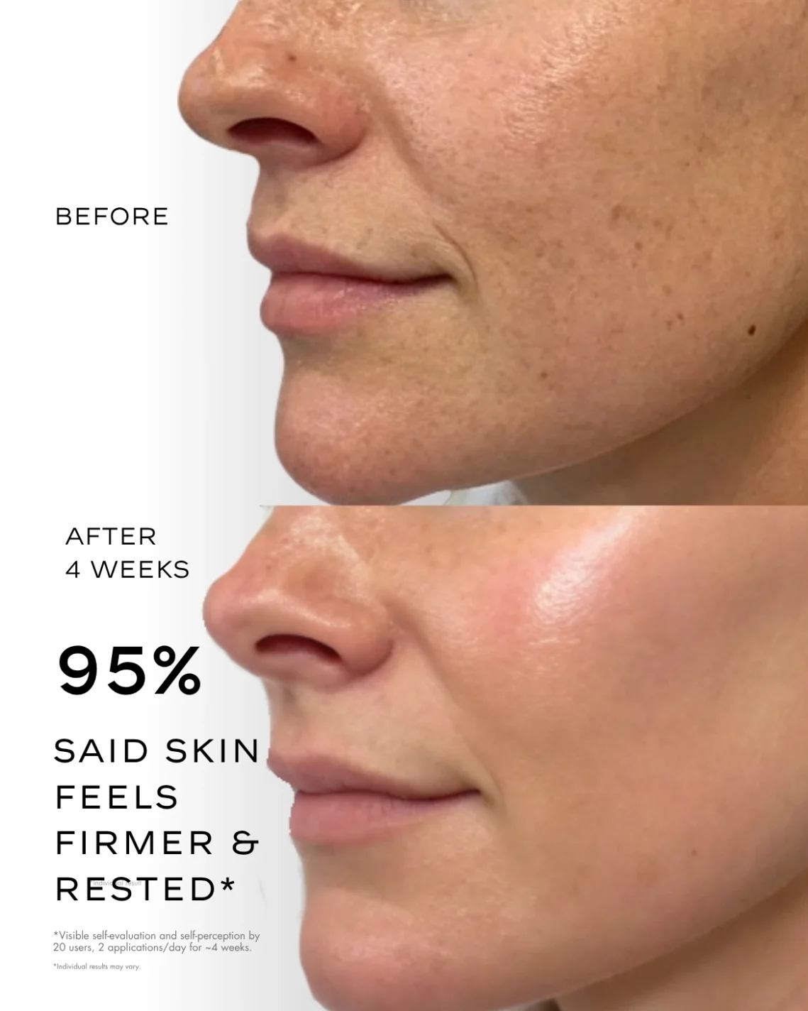 Before and after skincare results with the cream