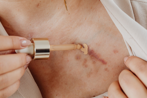 Inflammaging in Dermatology: What the Research Reveals