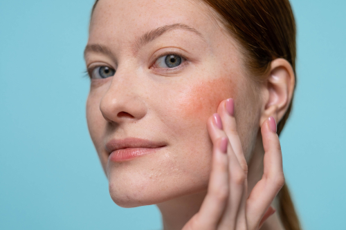 Microbiome Balance and Its Role in Skin Inflammation